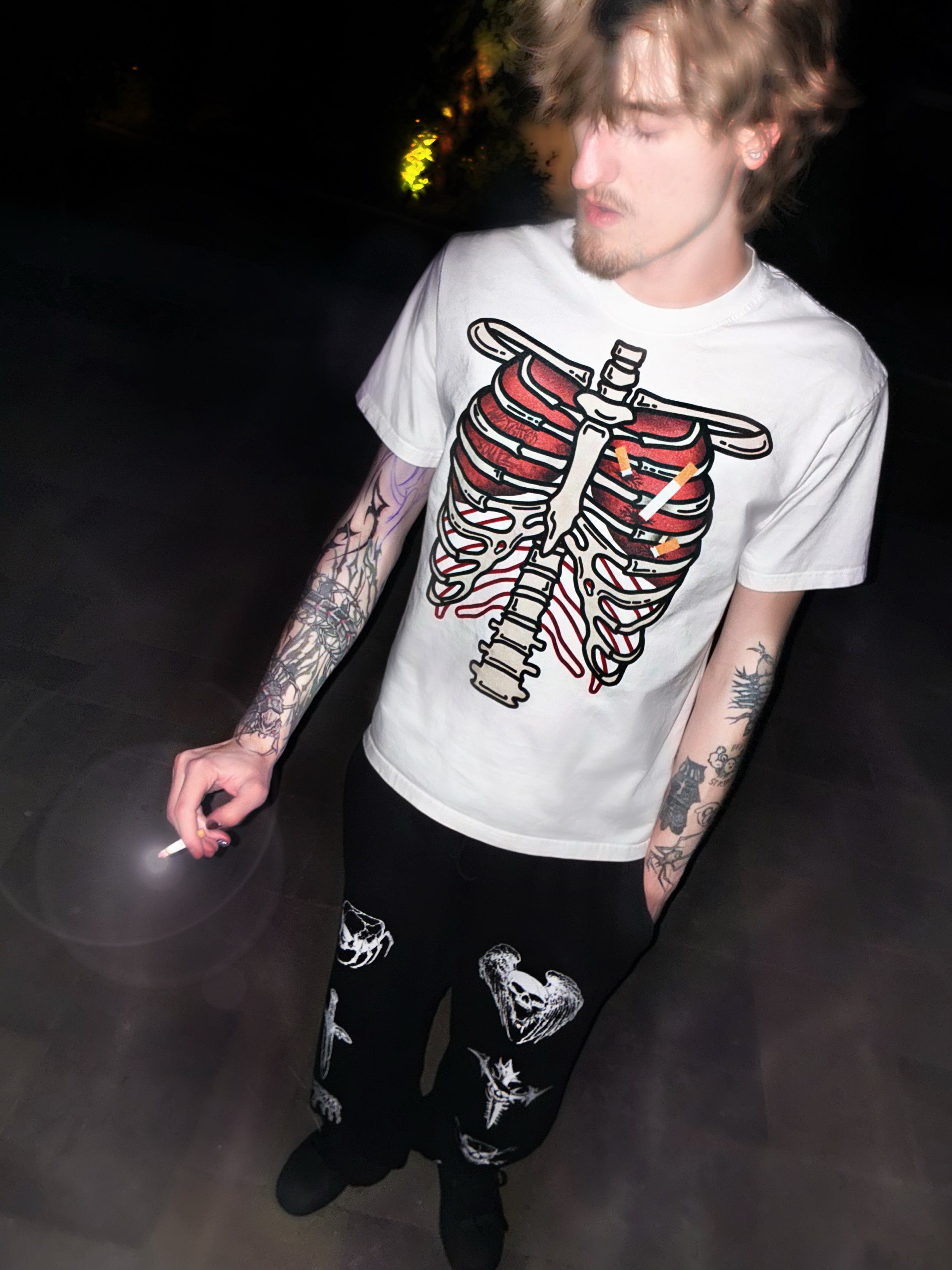 Pneumothorax Tee